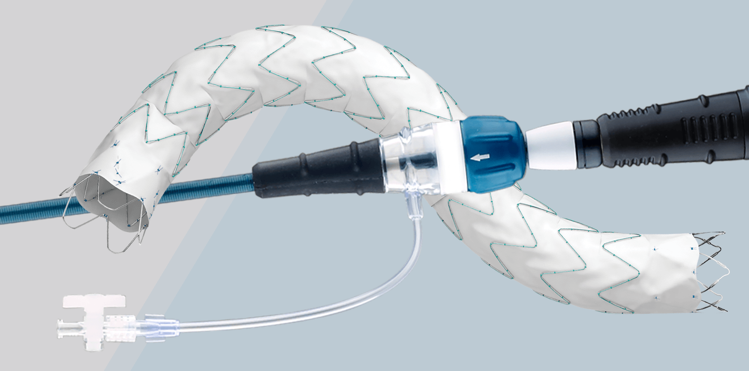 Zenith Alpha® 2 Thoracic Endovascular Graft and Delivery System